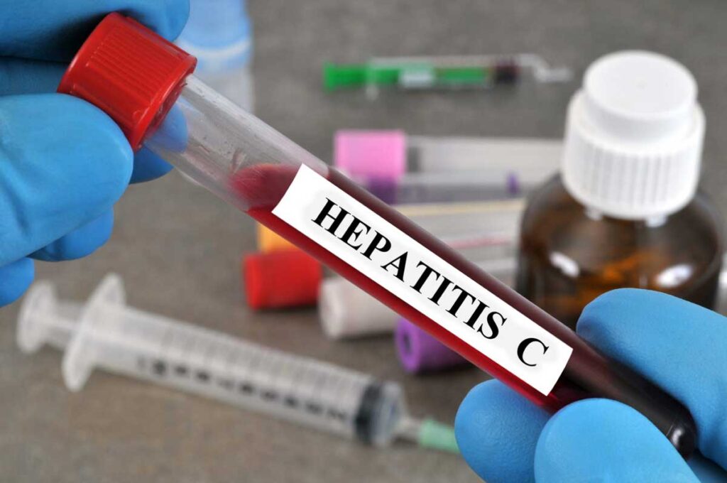 Major Cause Behind the Spread of Hepatitis C Revealed