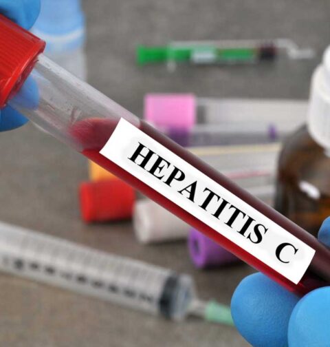 Major Cause Behind the Spread of Hepatitis C Revealed
