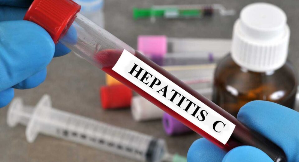 Major Cause Behind the Spread of Hepatitis C Revealed