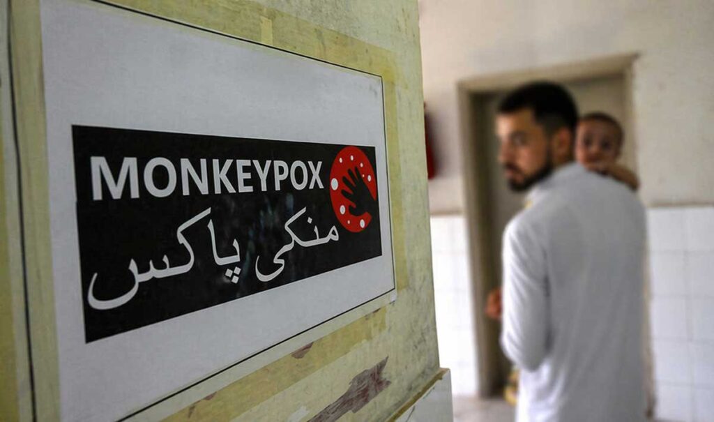 Mpox Cases Raise Concern in Sindh