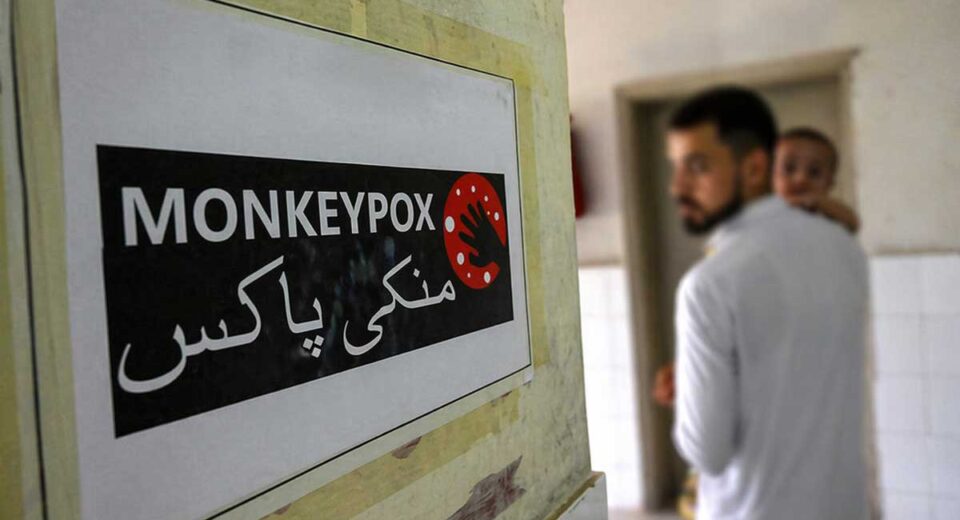 Mpox Cases Raise Concern in Sindh