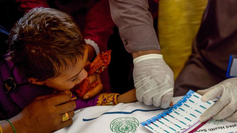 Khairpur Mpox Cases: Investigation Report Released, Causes of Death of Seven Newborns Revealed