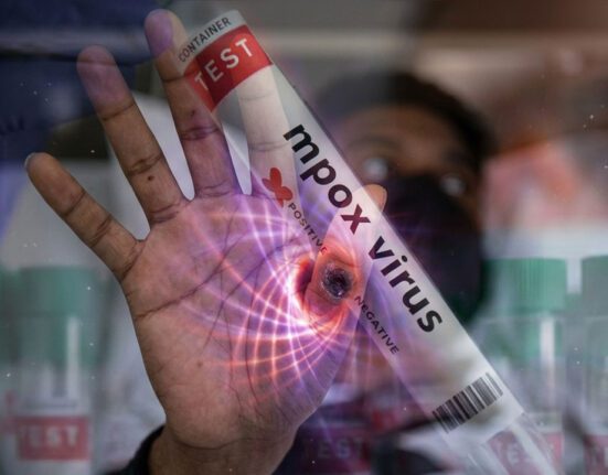 Mpox case confirmed in Karachi, health department issues alert and initiates response