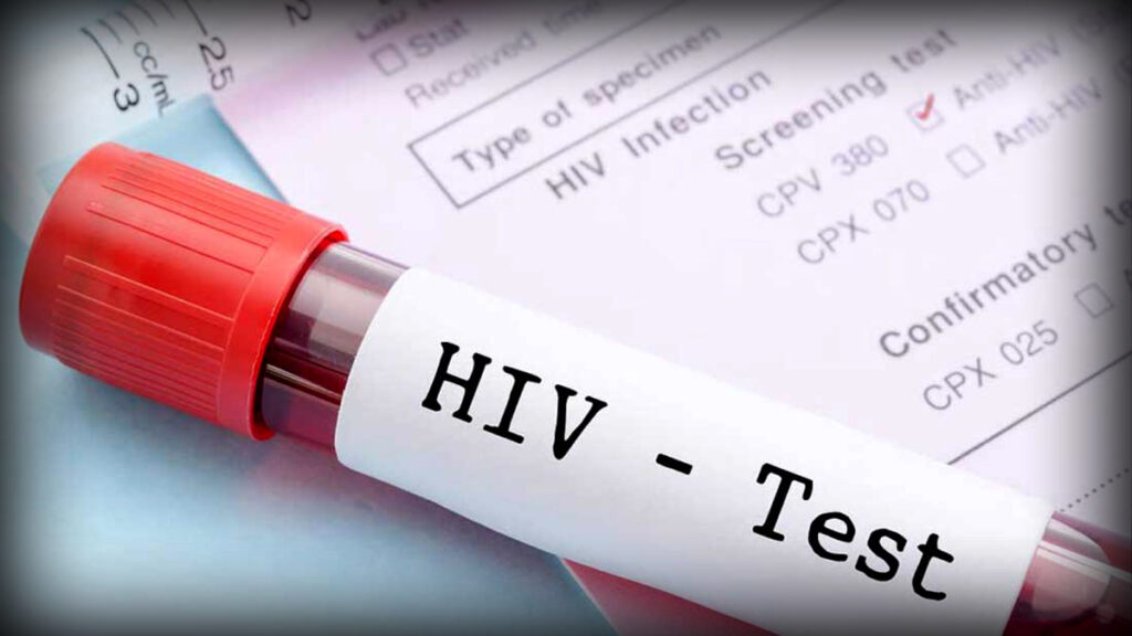 HIV: Only 25 Percent Patients in Pakistan Are Aware of Their Disease